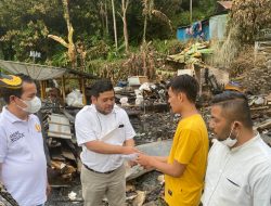 Andre Rosiade Bantu Korban Luka Bakar Akibat Kebakaran di Sungai Batang Agam